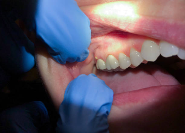 Best Dentist for Severe Toothache  in Ramsey, MN